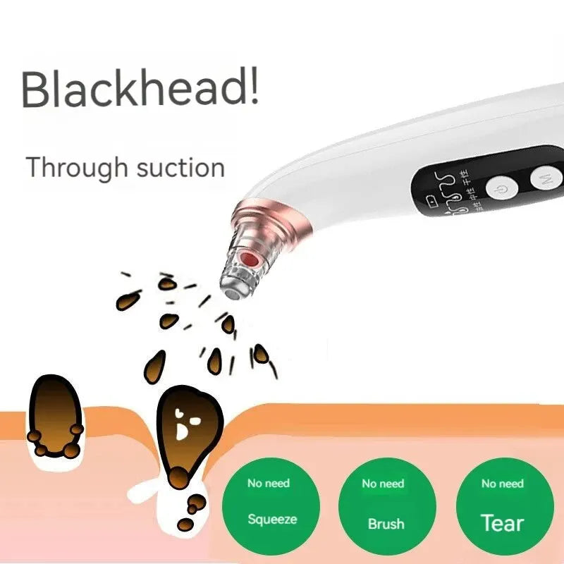 Electric Blackhead Remover